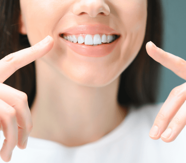 Dental Crowns in Marlow