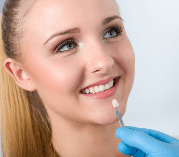 Dental Veneers in Marlow